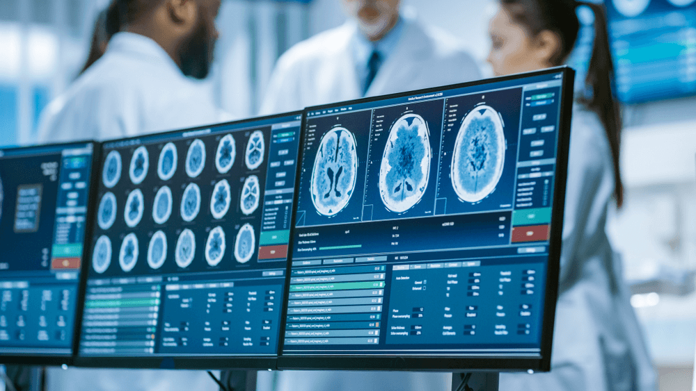 Computerbildschirm mit MRT- und CT-Bildscan des Gehirns