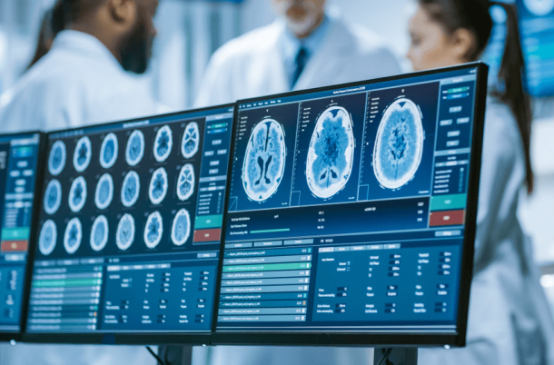 Computerbildschirm mit MRT- und CT-Bildscan des Gehirns